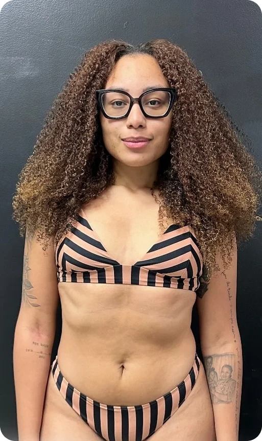 depois_01_vitaliti_1x